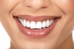 Woman teeth / photo from http://www.beautyhealthwomen.com
